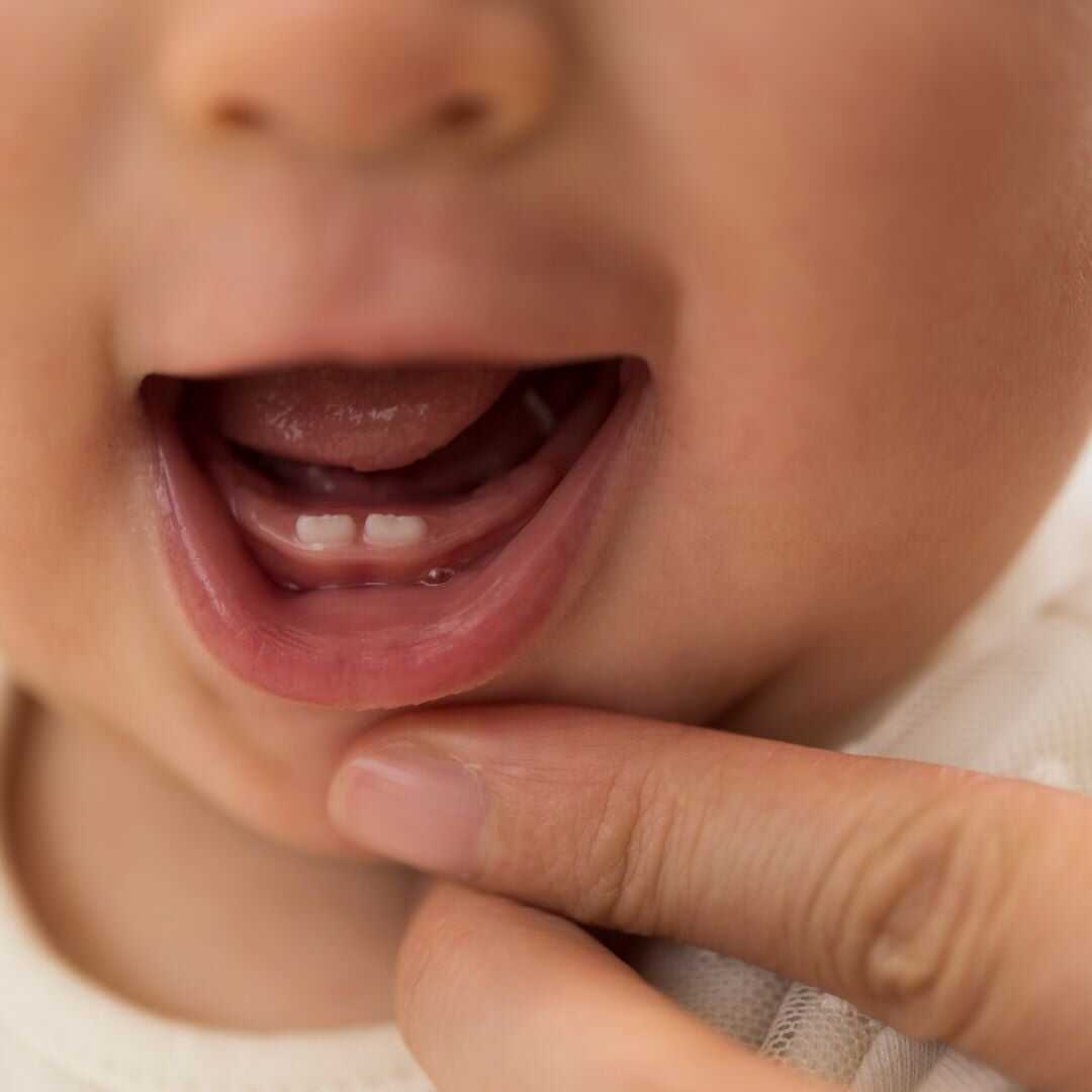 Close-up of a baby's lower gum with the first two teeth coming through