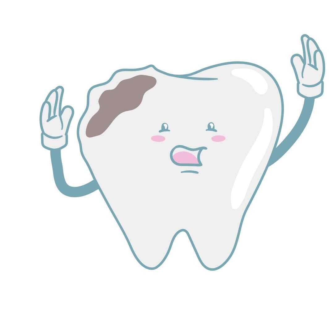 Cartoon illustration of a chipped front tooth