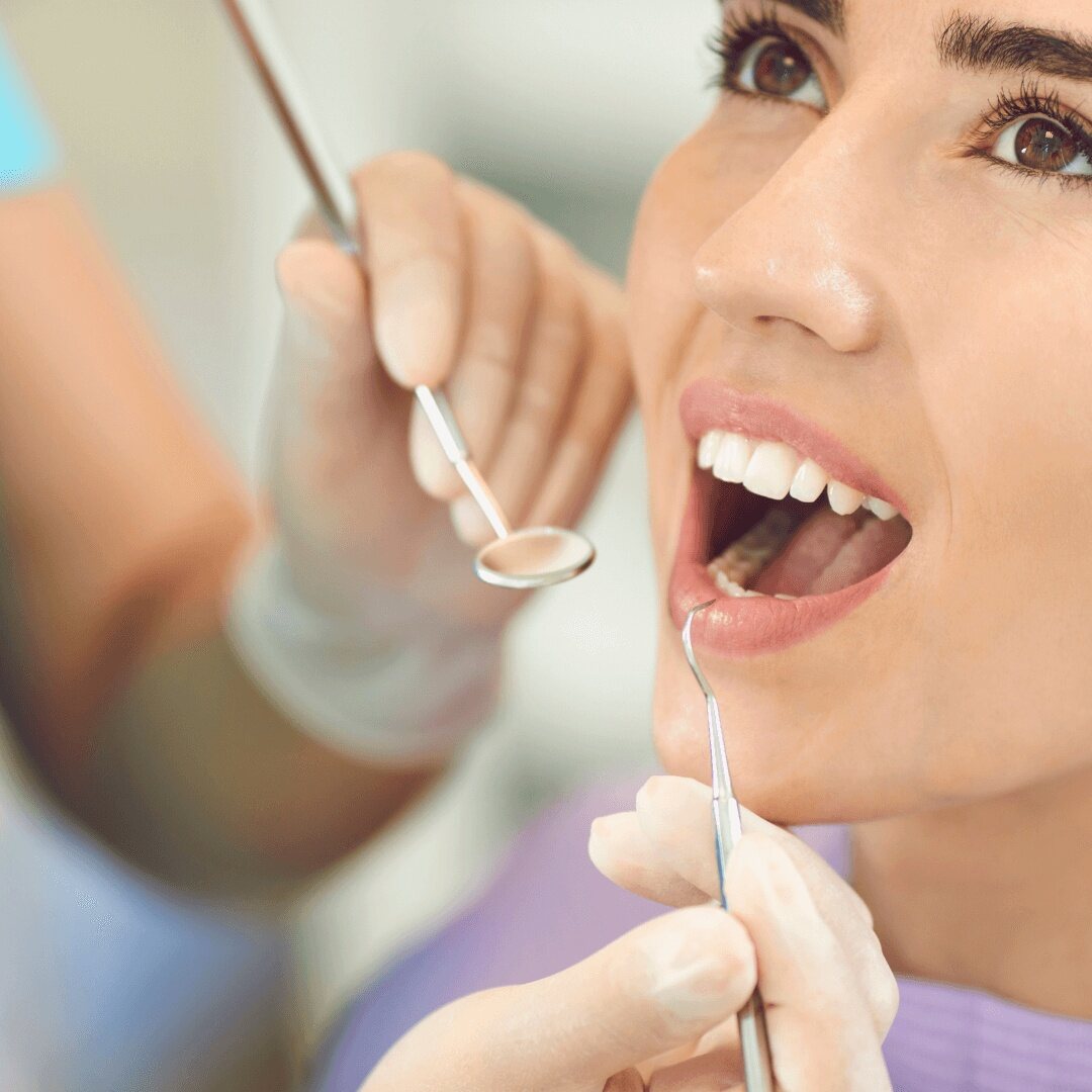 A patient's teeth being checked with a mirror and scaler before whitening