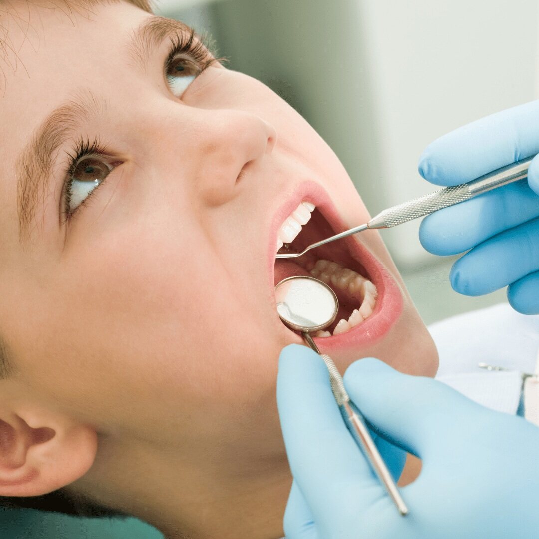 Close-up of teeth being examined with a dental mirror and probe